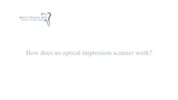 What is Digital Impression Technology by Dr. Larry Brent
