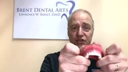 SureSmile® custom fit aligners @BrentDentalArts