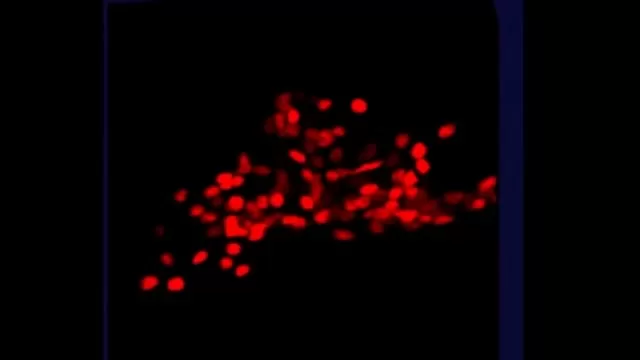 Princeton video shows a worm's brain light up as it thinks