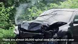 rinceton Innovation Nerve Damage Repair